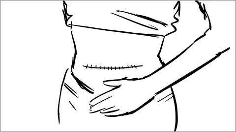 storyboard